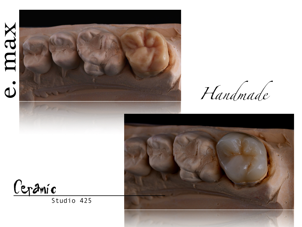 INCISAL EDGE 2.021.jpg