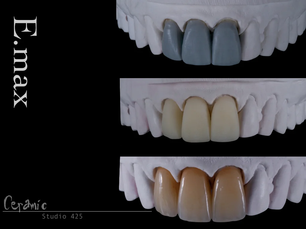INCISAL EDGE 2.023.jpg