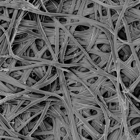Microscopic image of a silken protein structure.