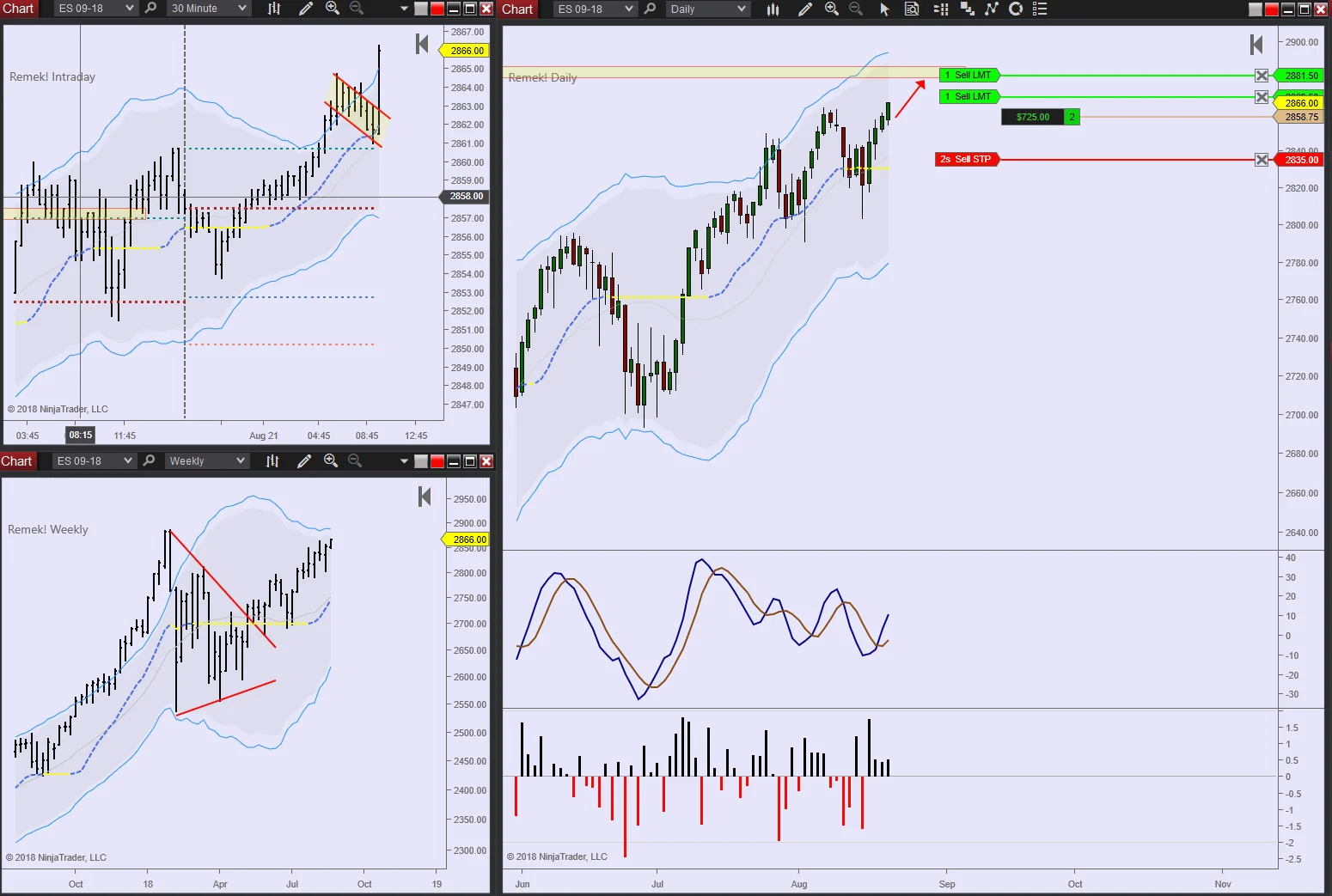 ES 2018 08 21 9.30am.jpg
