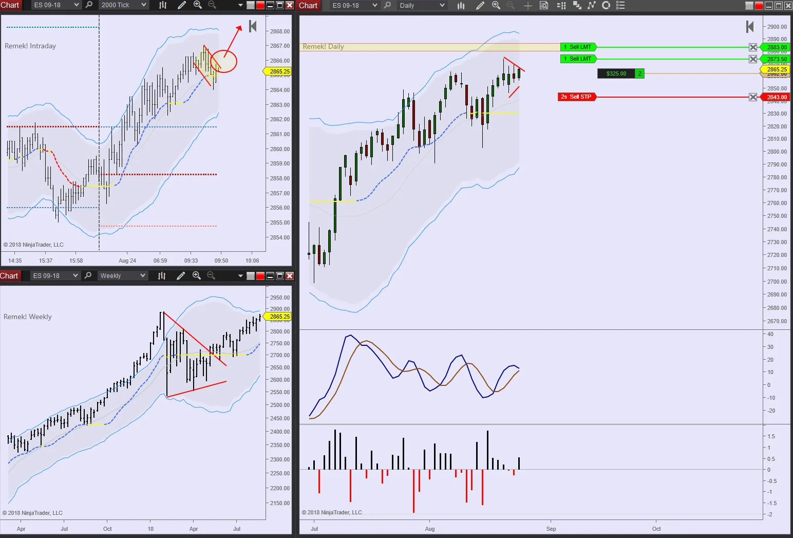 ES 2018 08 24 9.50am