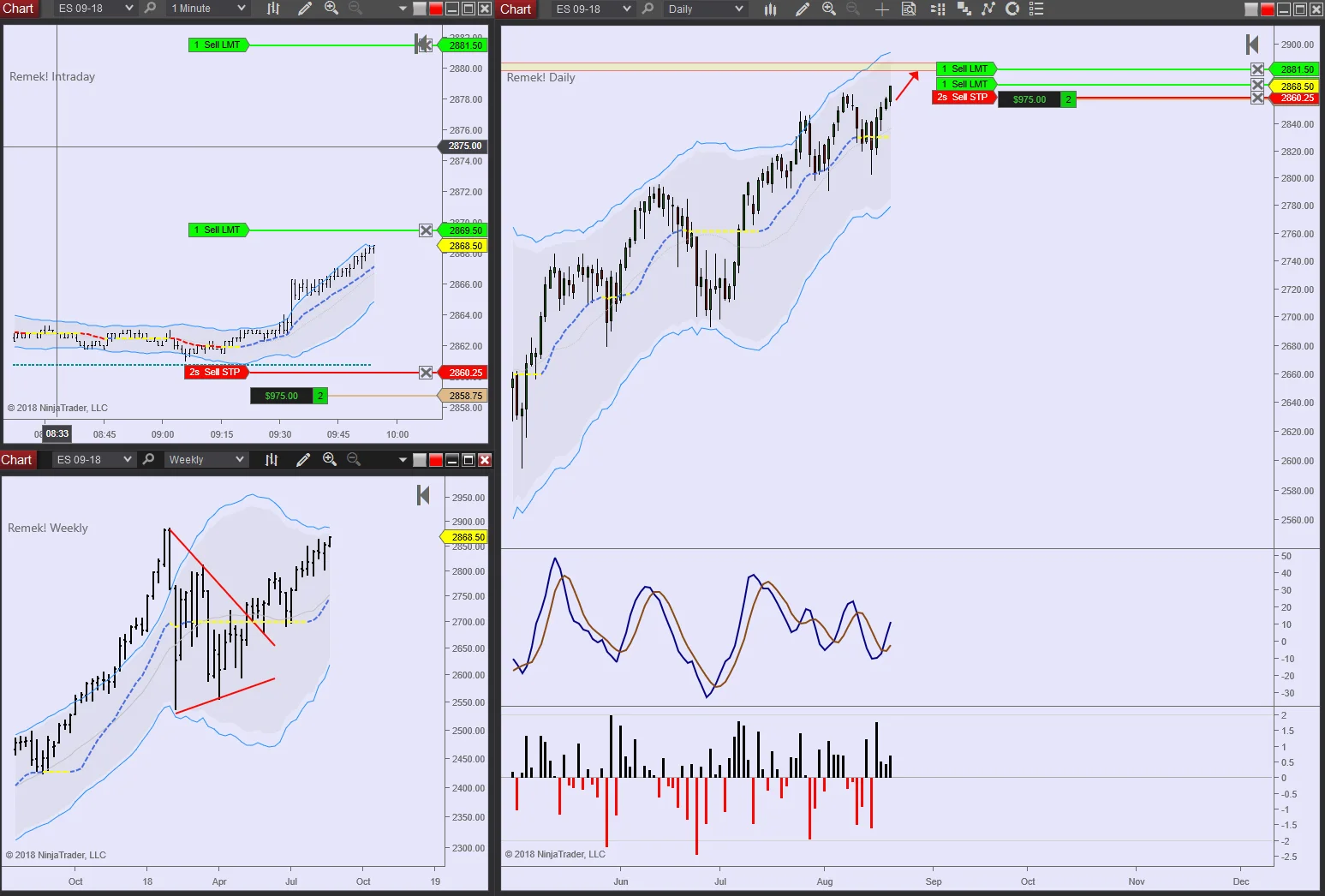 ES 2018 08 21 9.50am.jpg