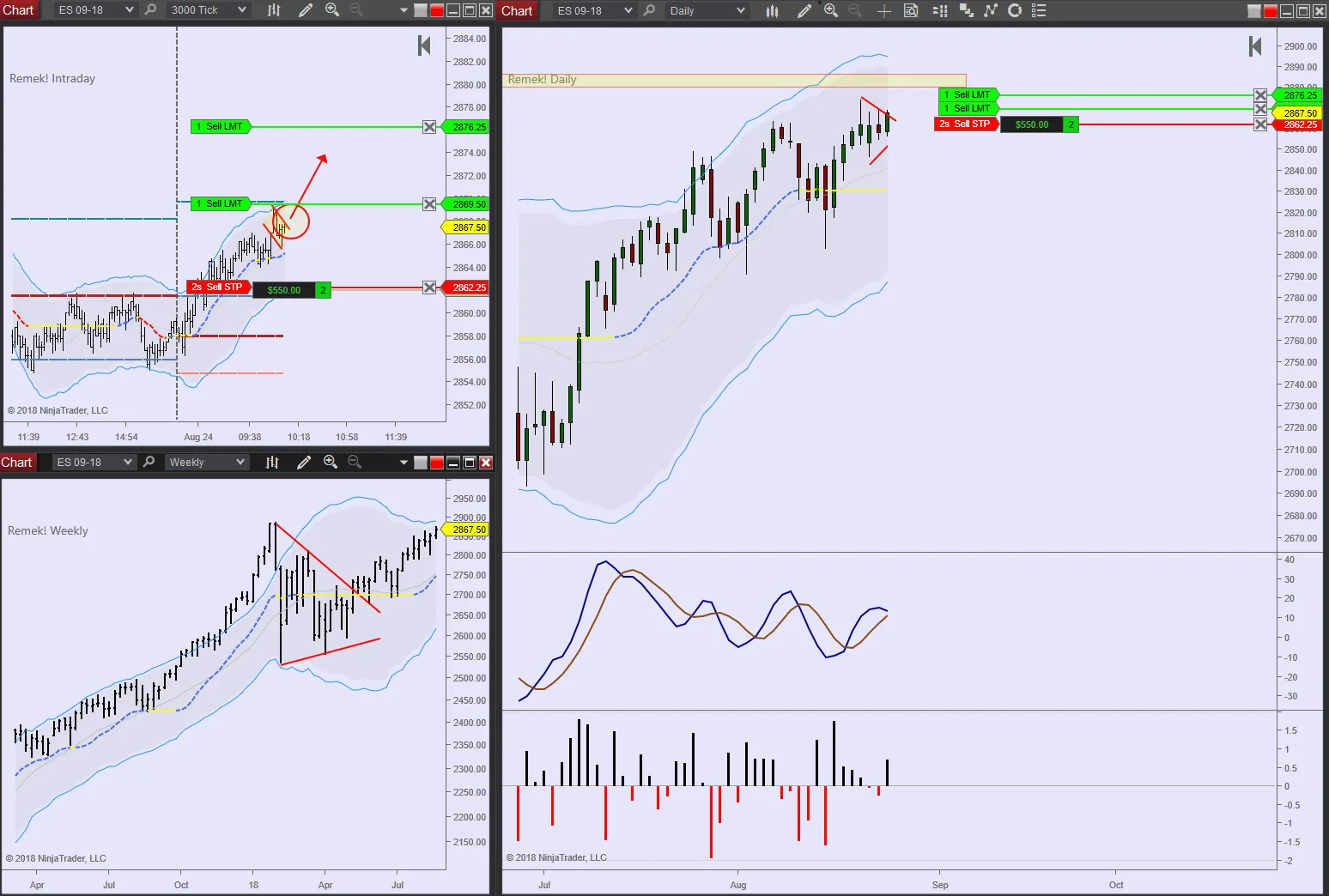 ES 2018 08 24 10am.jpg