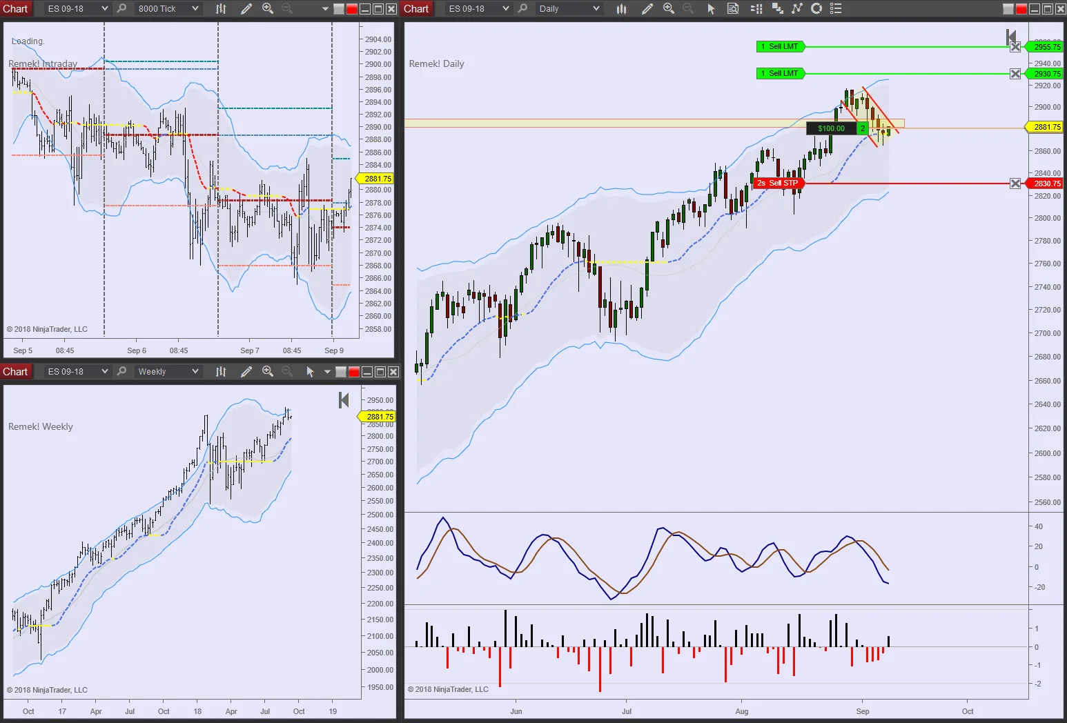 ES 2018 09 09 10pm.jpg