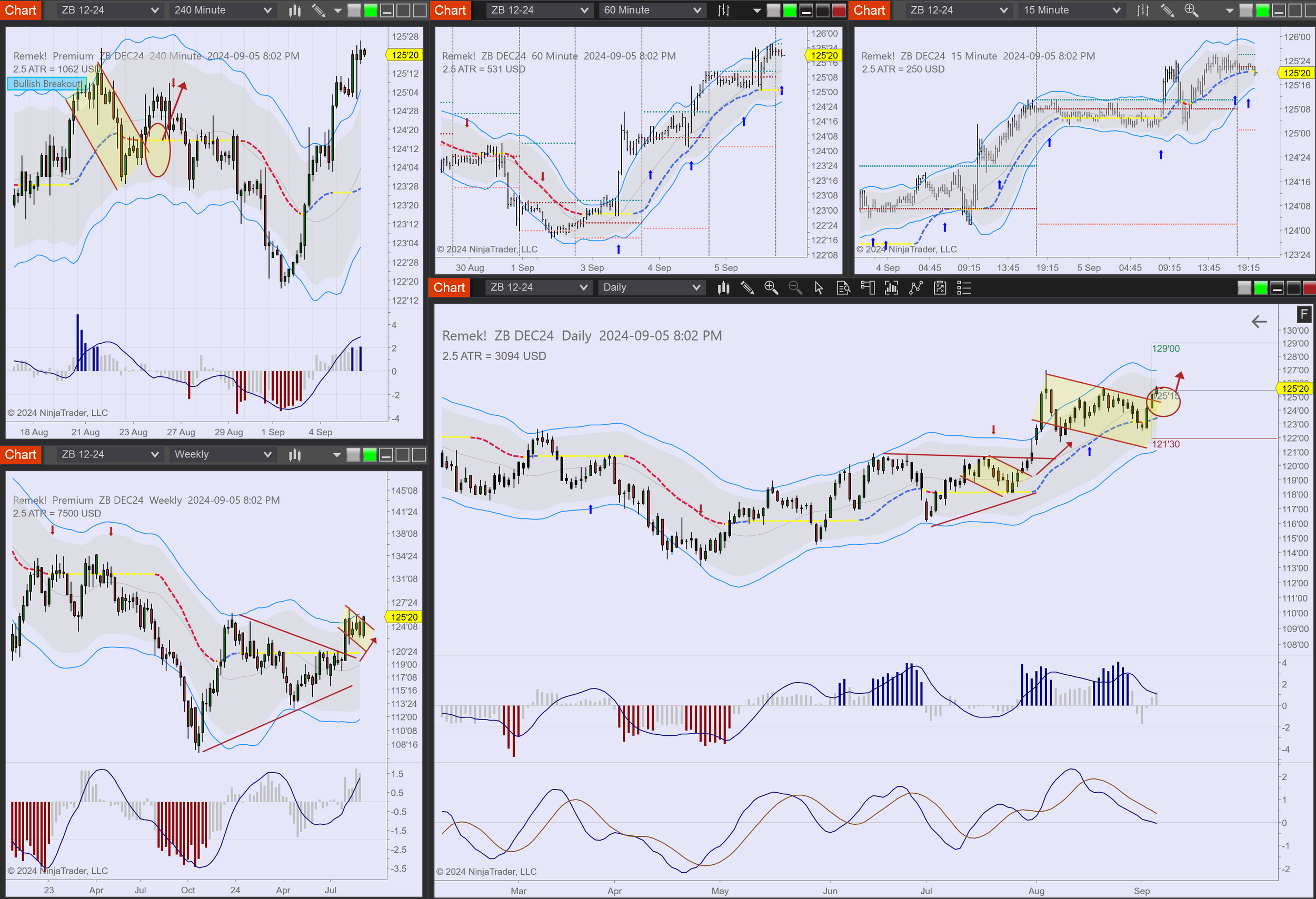 2024-09-05 20_02_24-Chart - ZB DEC24 ZB DEC24 Daily.png