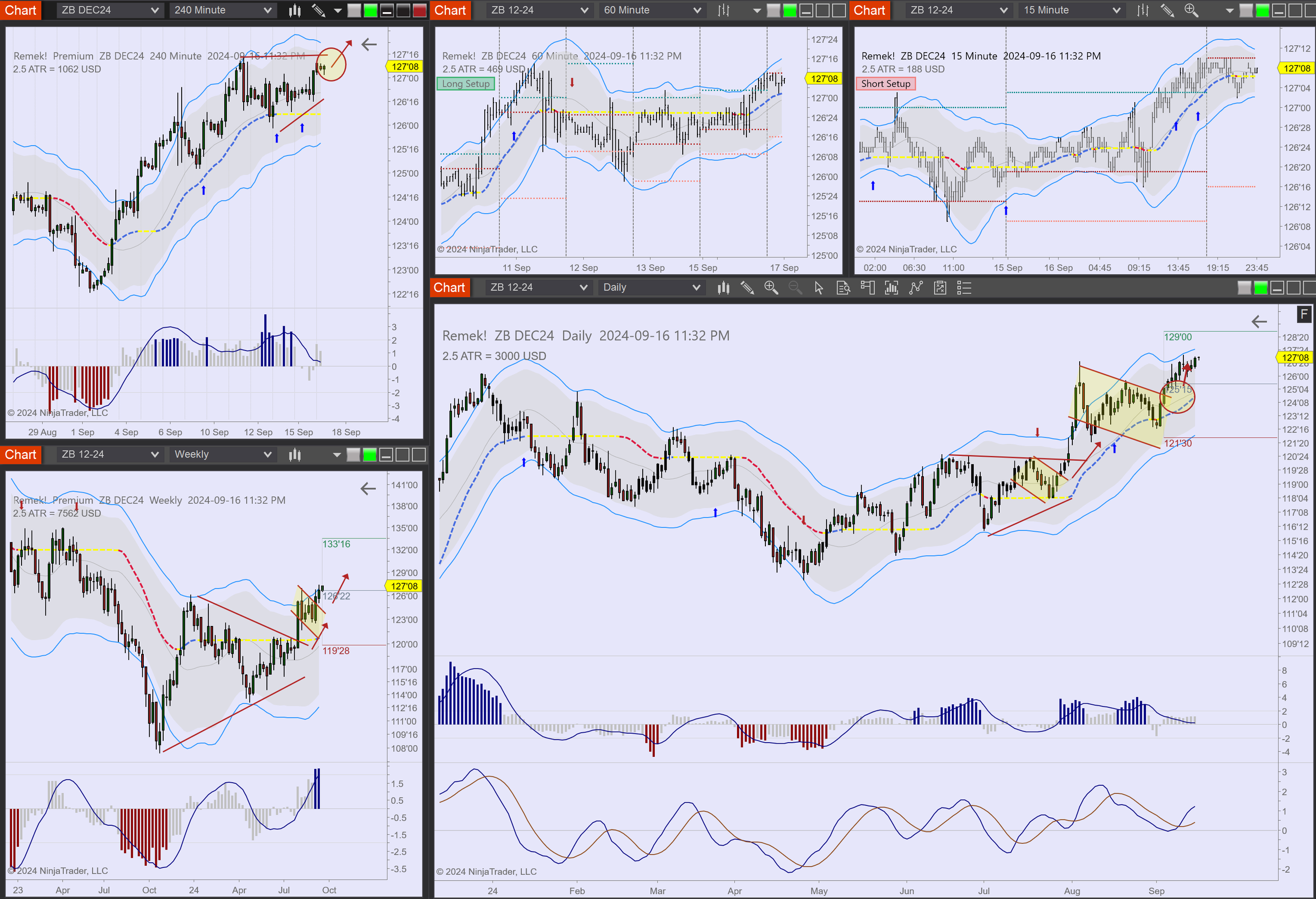 2024-09-16 23_32_30-Chart - ZB DEC24 ZB DEC24 Daily.png