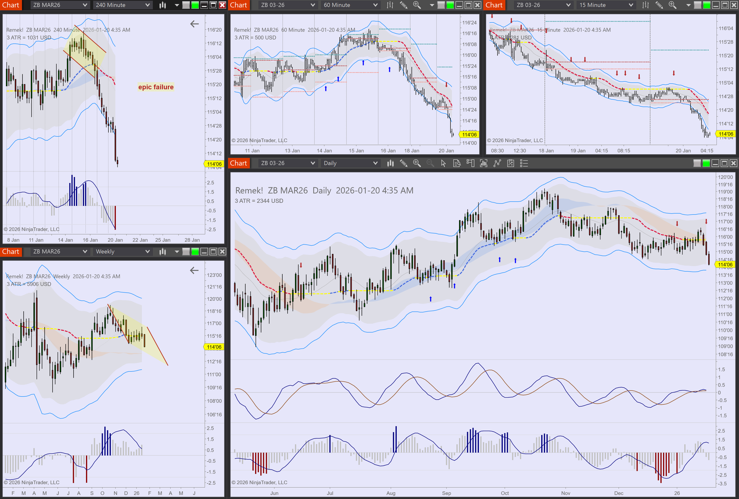 2026-01-20 04_35_24-Chart - ZB MAR26 ZB MAR26 Daily.png