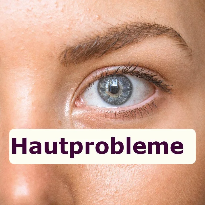 Hautprobleme