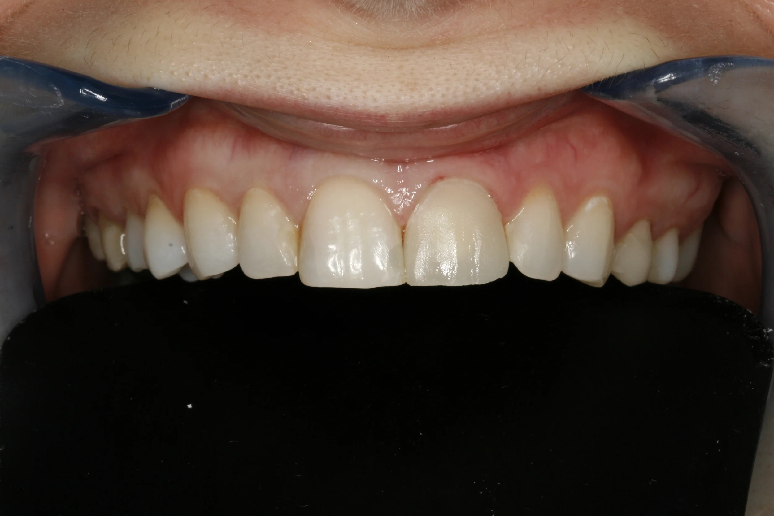 After