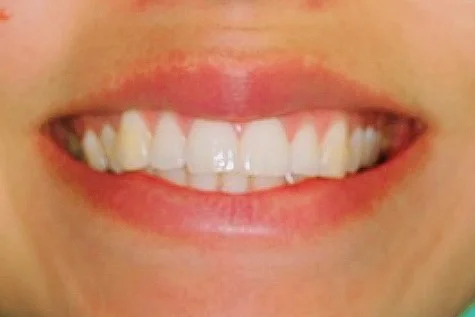 Before.jpg