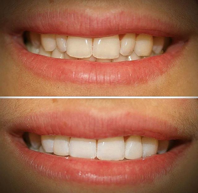 Dentist Kensal Rise, Ladbroke Grove & Notting Hill The Hub Dental Rooms
