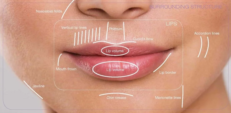 Big lips might be trendy, but they do tend to look out of place.