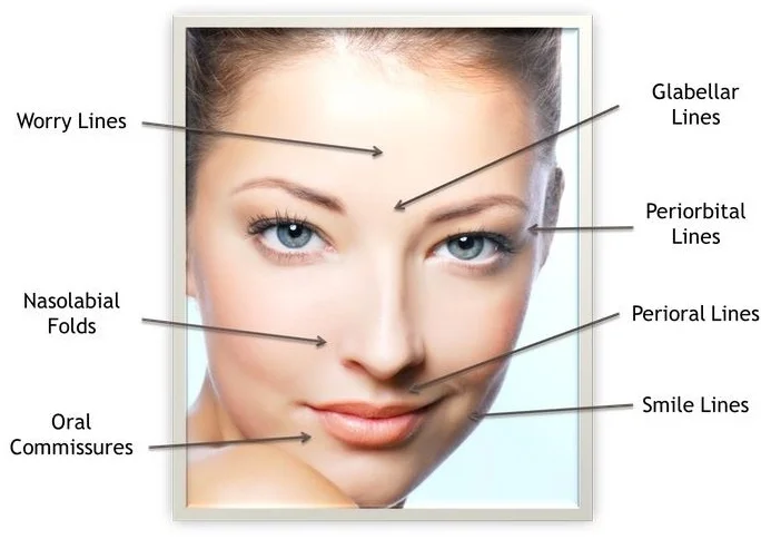 Botox%252Band%252Bfiller%252Bareas.jpg