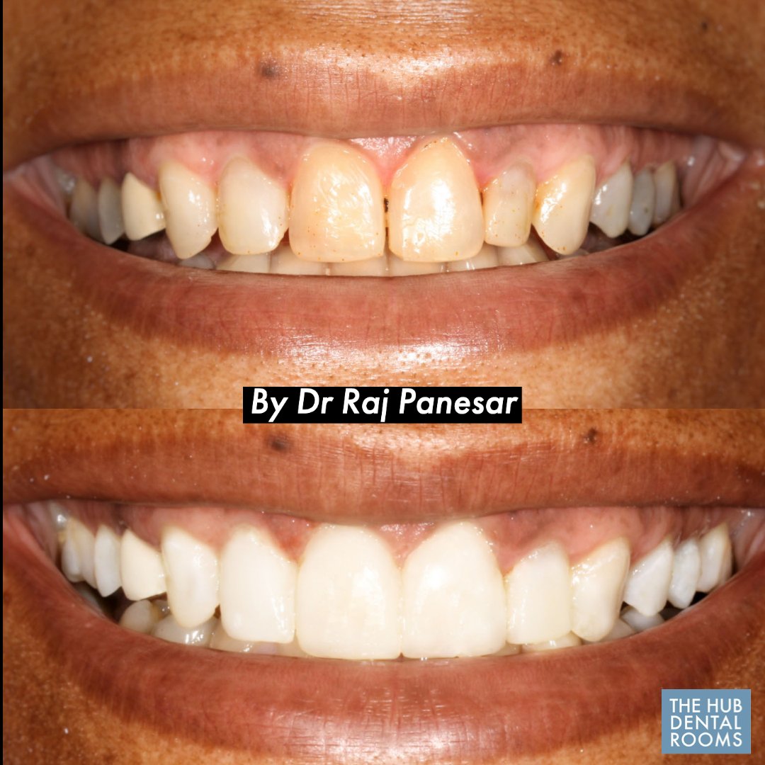 Dentist Kensal Rise, Ladbroke Grove & Notting Hill The Hub Dental Rooms