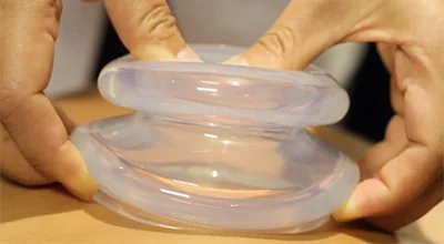 siliconecupping.jpg
