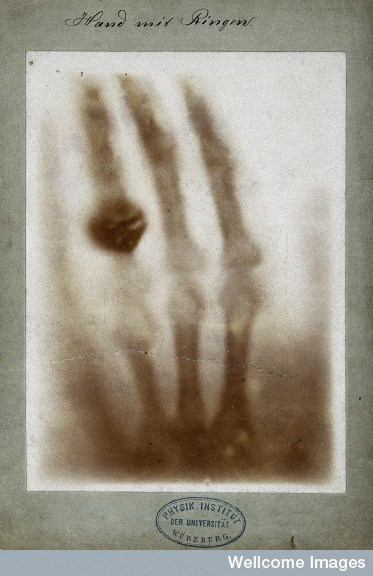 Image courtesy of Wellcome Library