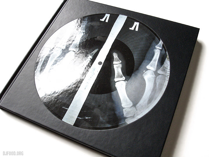 X-Ray-AudioBookcover1-720x540.jpg