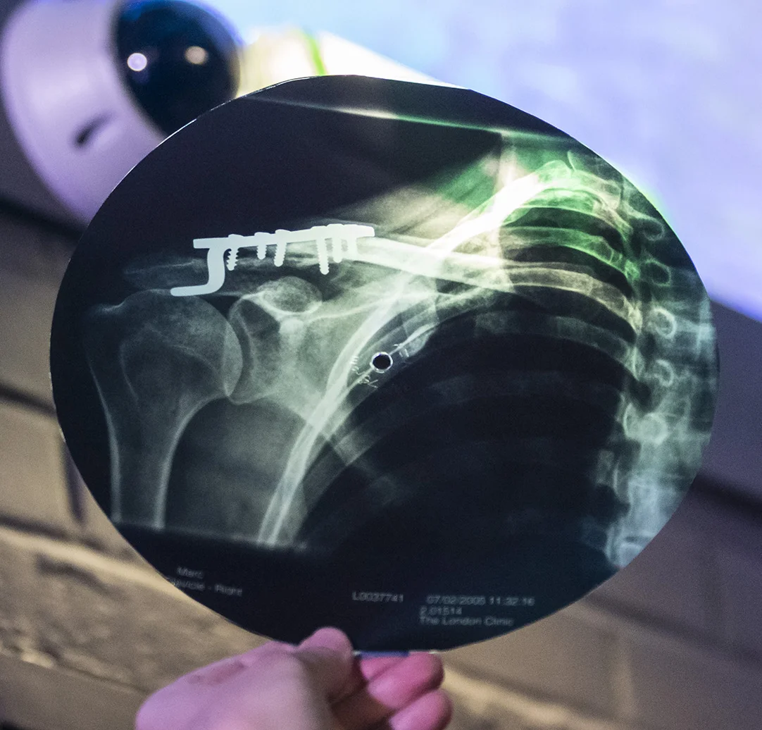 Modern x-ray record of Marc Almond performing Vadim Kozin’s song Druzbha (Friendship) at Rough Trade Records 2017