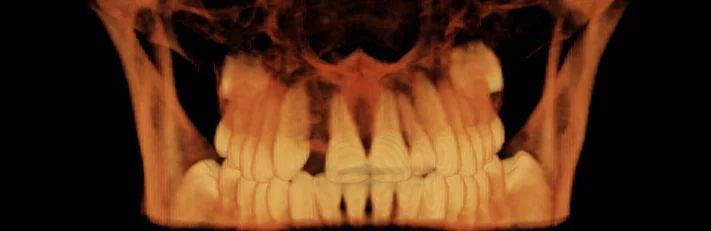 Legacy 3D Imaging 3D reconstruction cropped sample image.jpg