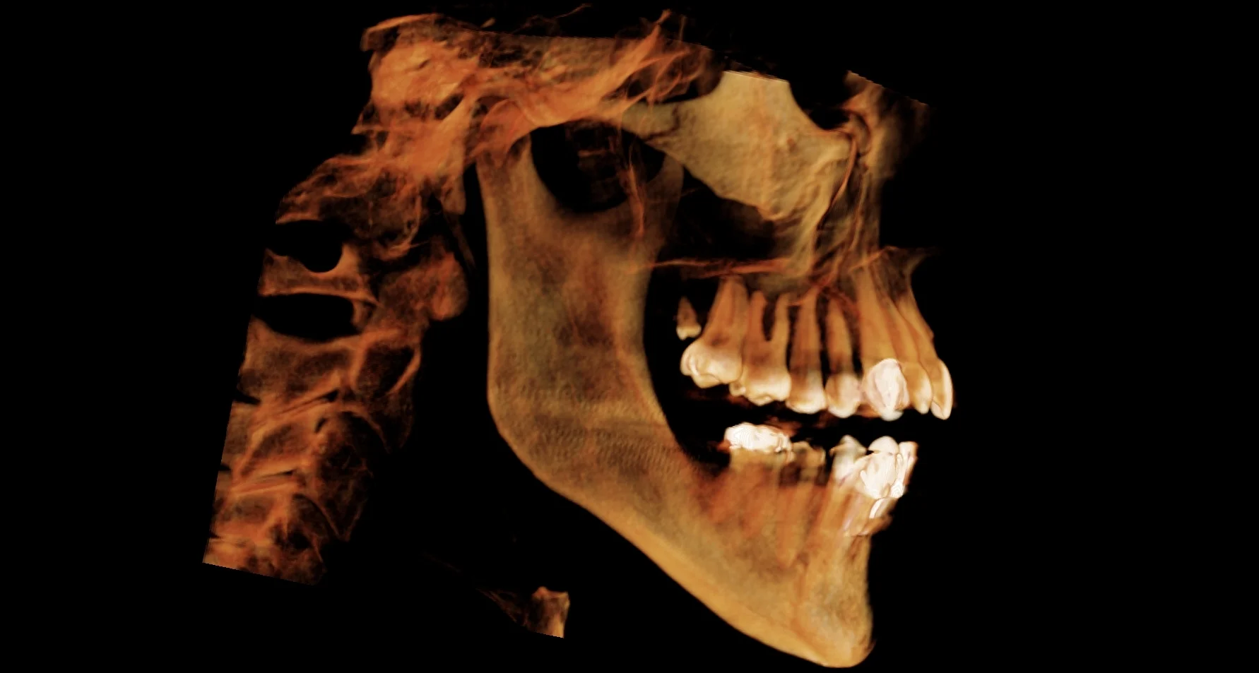 RS_microdont 3D reconstruction.jpg