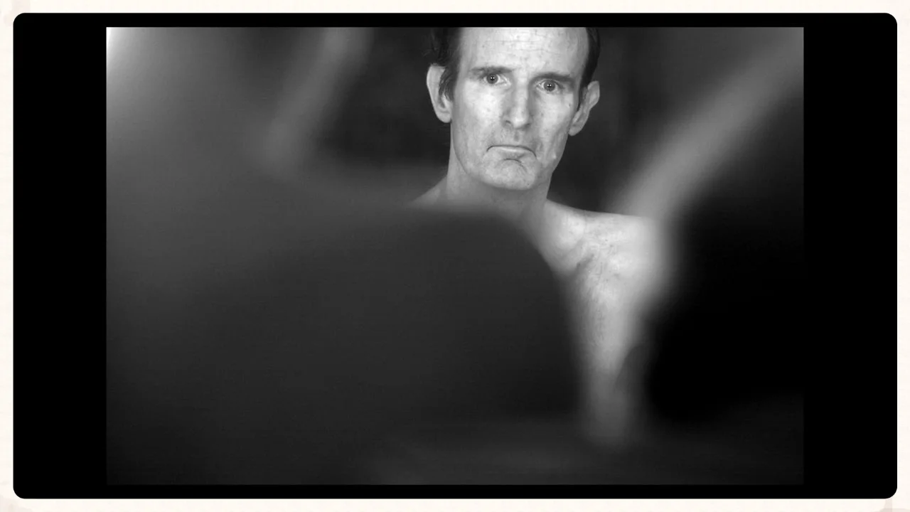 Early onset Alzheimers