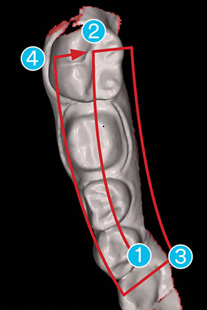Figure 7. Scan pattern for quadrant recommended for True Definition Scanner (3M).