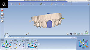 Figure 12b. Alternate view of design proposal.