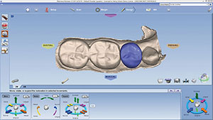Figure 18. Evaluation of design proposal, tooth No. 29.