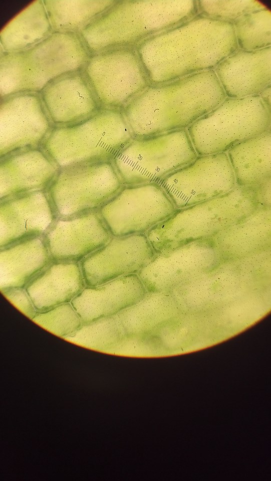Elodea cells in distilled water