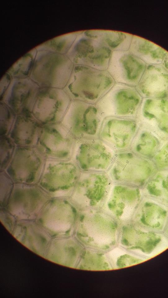 Elodea cells in salt water