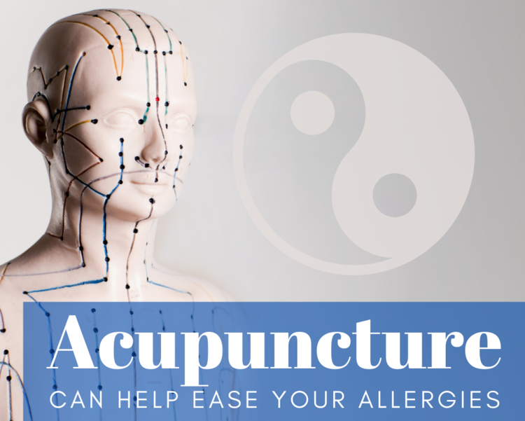 Image of acupuncture model with text reading ‘acupuncture can help ease your allergies’