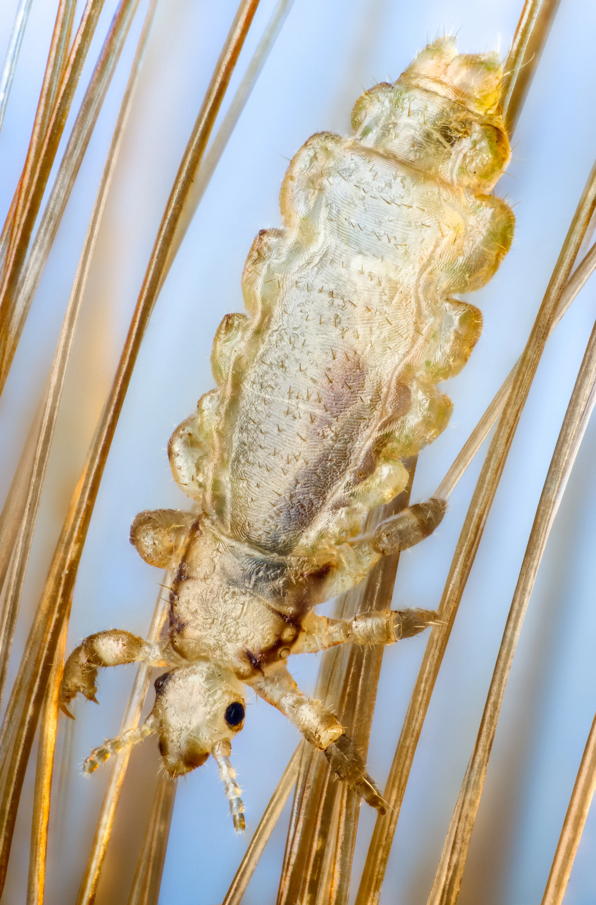 Studio stack: Head louse