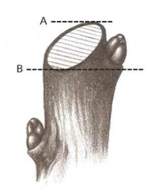 A proper cut slopes gently to shed rain. The top of the cut (A) is just above the bud, while the base (B) is level with the bud.