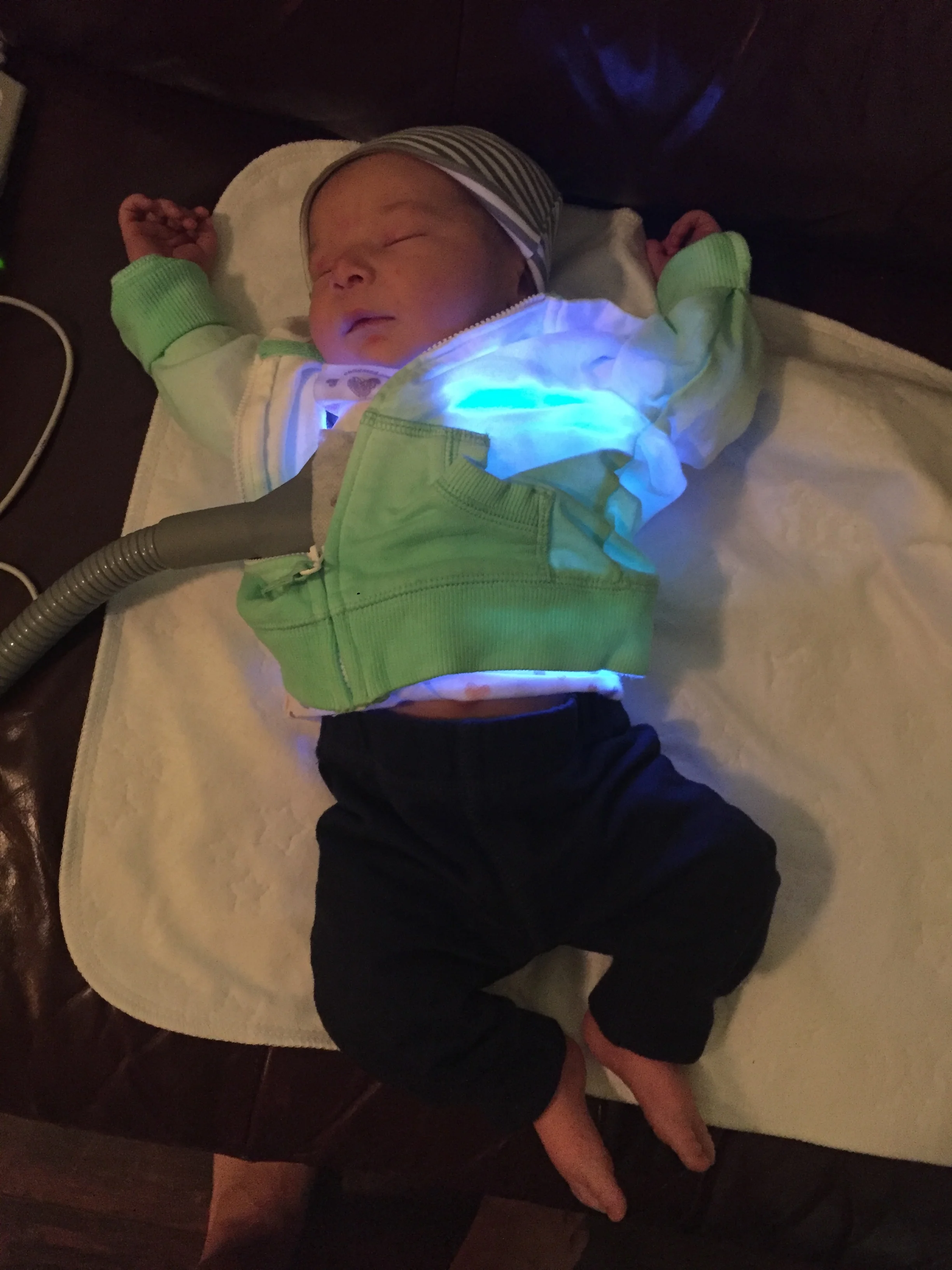  We were sent home with a UV belt, after high bilirubin levels, to help manage Enoch’s jaundice. He had to have it on at all times, even through feeding and sleeping. 