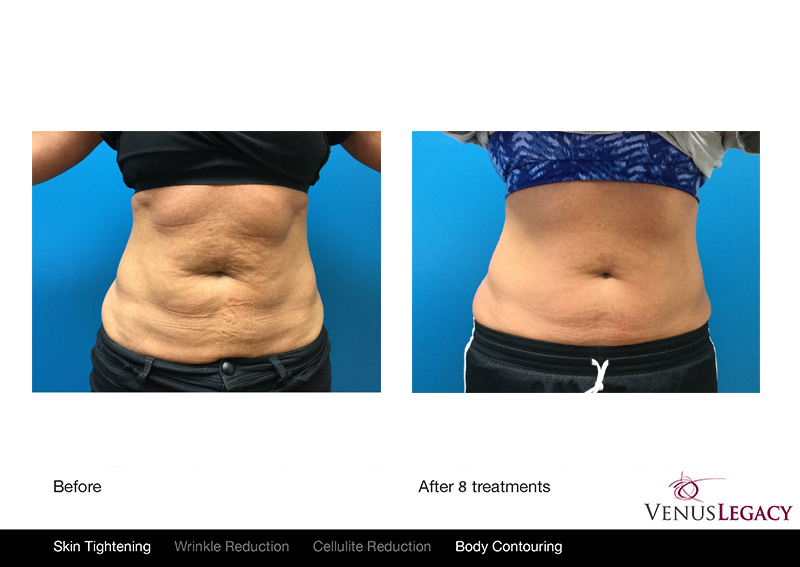 4ABDOMEN.jpg