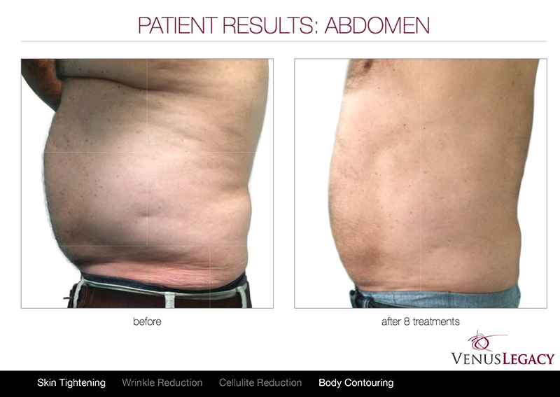 5ABDOMEN.jpg