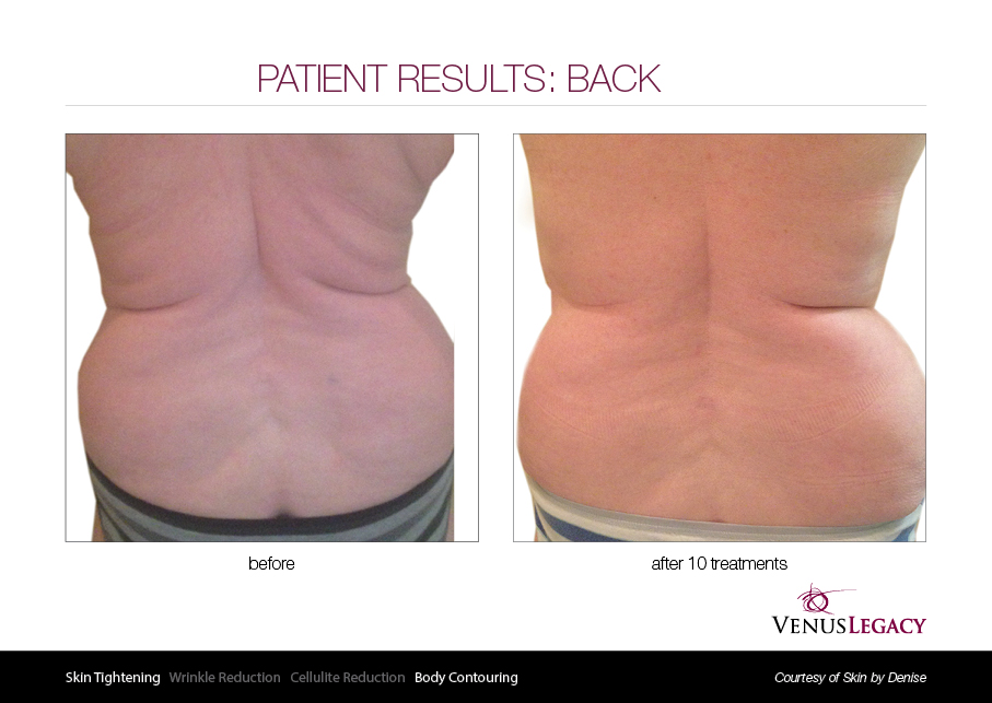 VLE__Before&After_017.jpg