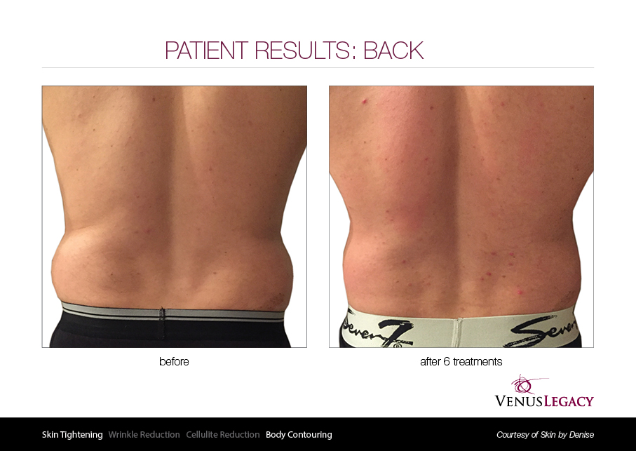 VLE__Before&After_018.jpg