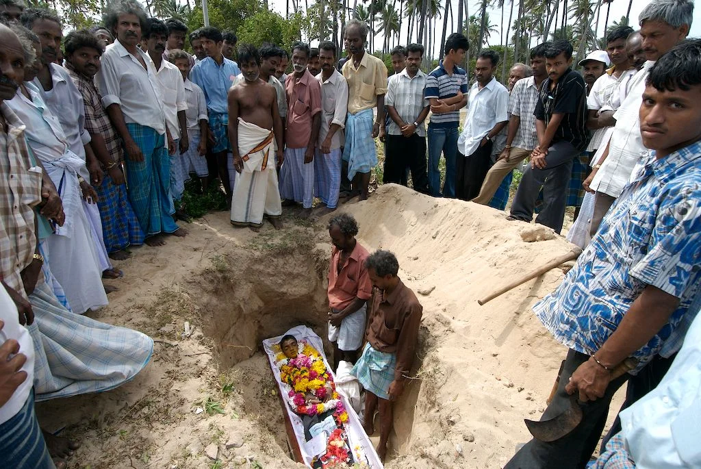  Child victim of the chikungunya epidemic exacerbated by the siege and civil war, Jaffna, Sri Lanka, 2007 