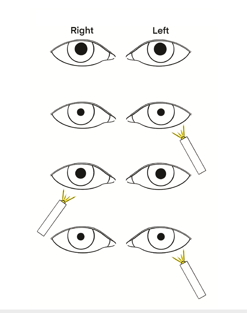 Diagnostics: Ophthalmologic Trauma — Taming the SRU