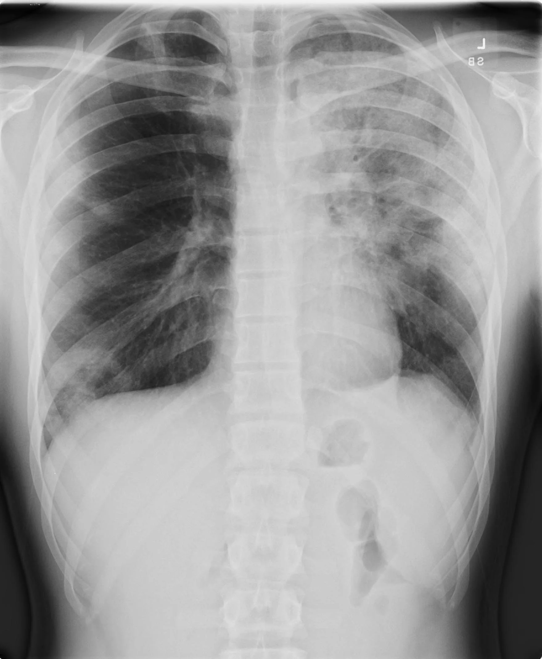 Grand Rounds Recap 7/9/2014