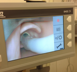 Correct placement of blade gives you a "cheap seats" view of the glottic opening