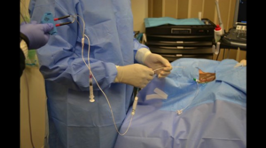 Transvenous Pacemaker Insertion - Part 3