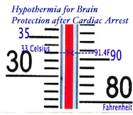 Lessons in Transport - Hypothermia Part 2