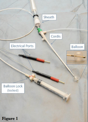 Transvenous Pacemaker Placement - Part 1: The Walkthrough — Taming the SRU