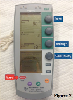 Transvenous Pacemaker Placement - Part 1: The Walkthrough — Taming the SRU