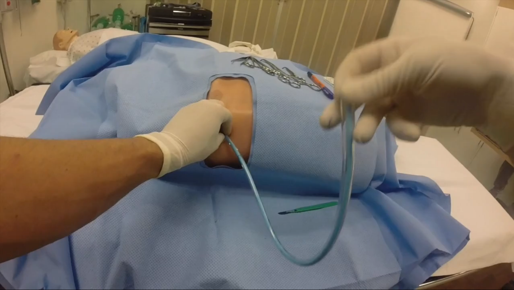 BougieAssisted Chest Tube — Taming the SRU