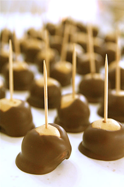 Right Upper Quadrant Ultrasound