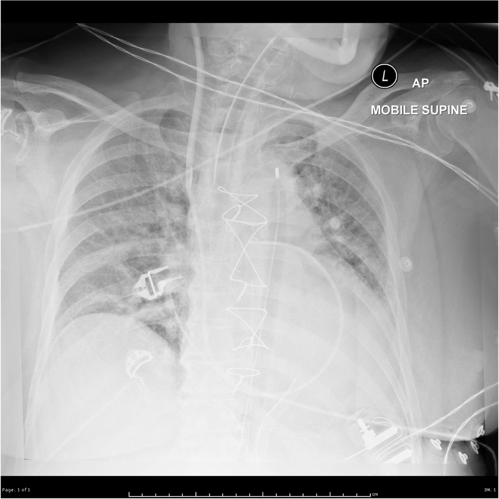 Grand Rounds Recap - 3/4/2014