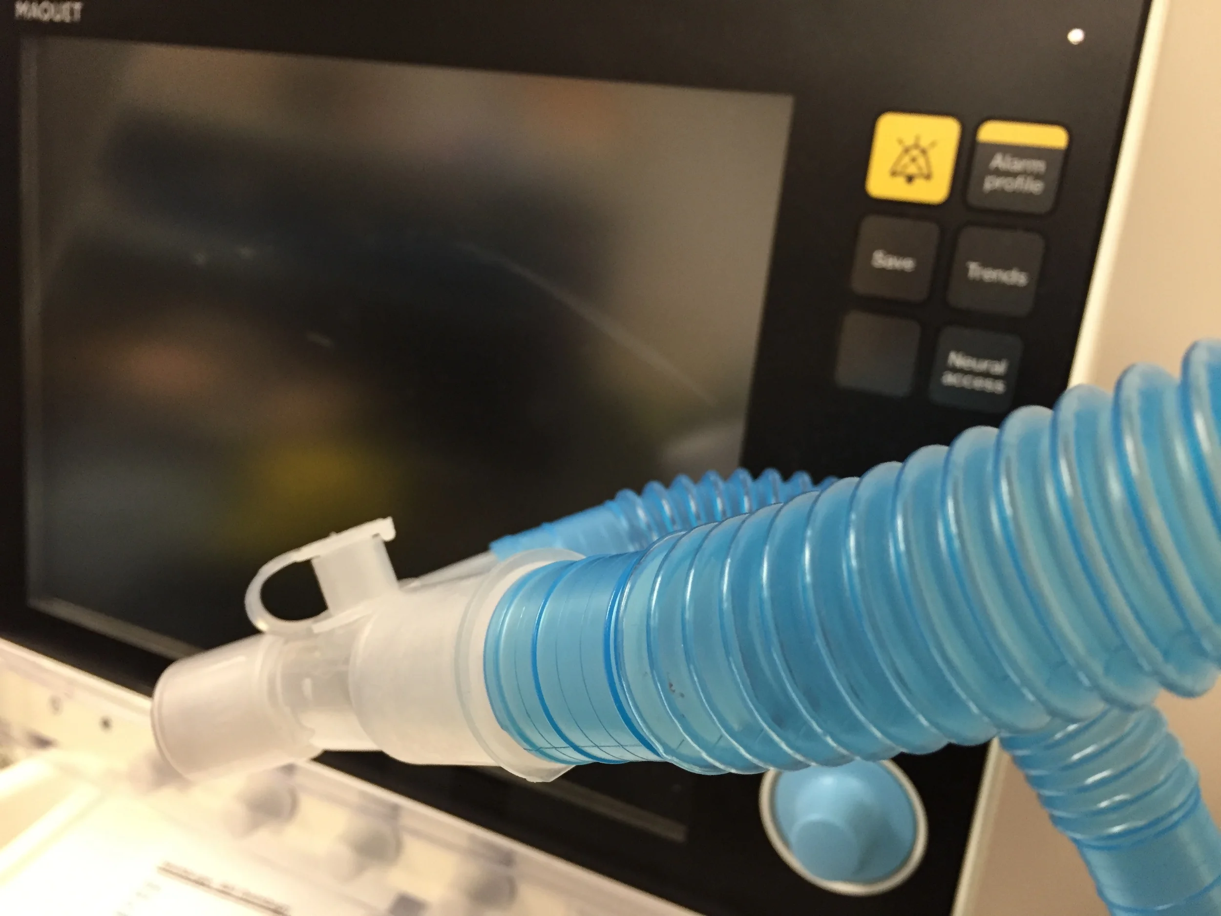 Grand Rounds Recap - 3/18/15